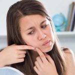 Πωσ σπαμε τα μαυρα στιγματα για να μην γινουν σπυρακια